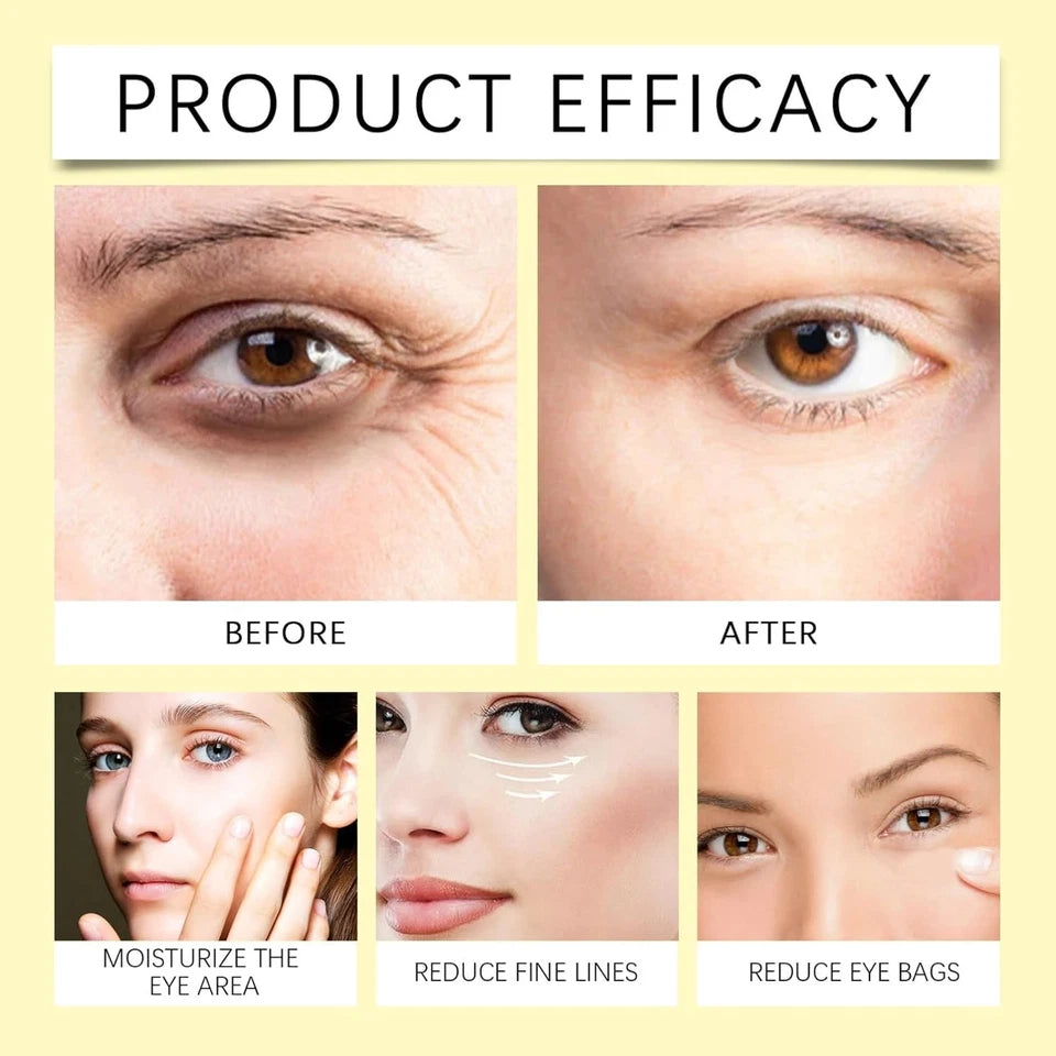Bee Venom Eye Cream Remove Dark Circles Lightening Anti Eye Bag Puffiness Firming Skin Fade Fine Lines Nourish Lifting Skincaer
