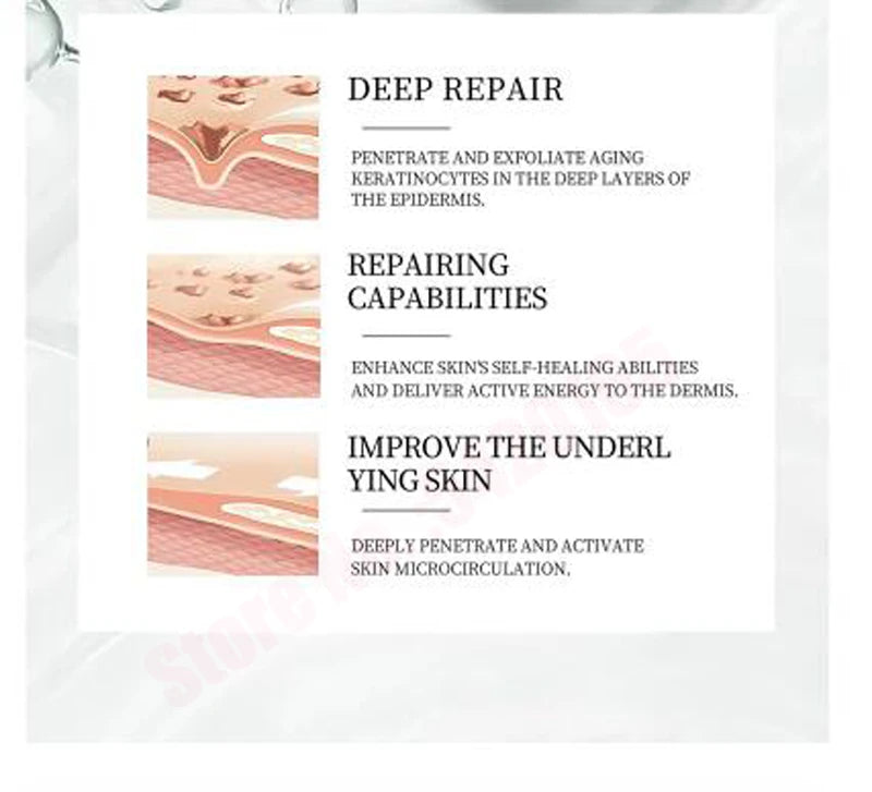 Algae Peeling Whitening Melasma Peel Kit Natural Seaweed Bone Plant Extract Mask Rejuvenation Moisturize Facial Skin Care