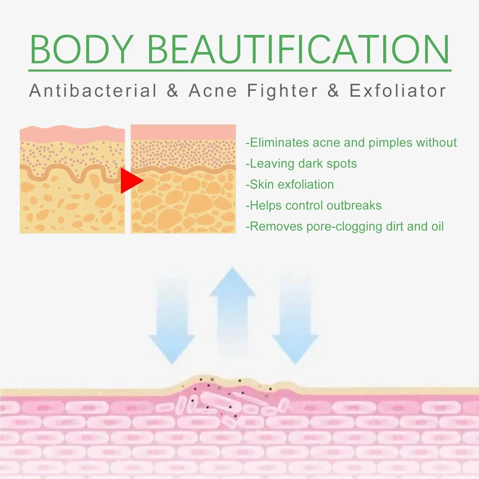 Body Acne Removal Cream Treatment Face Butt Back Acne Marks Smooth Repair Chicken Skin Cream Moisturizing Whitening Skin Care