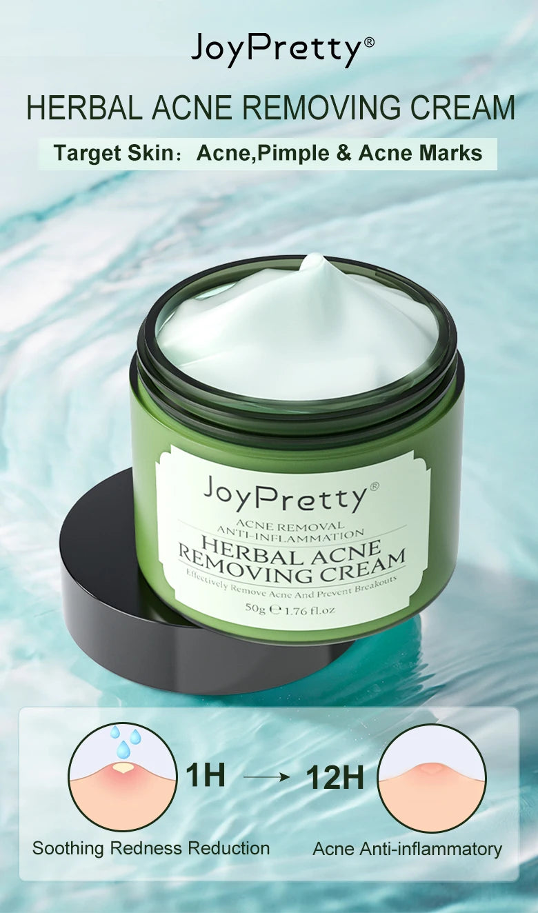 Herbal Acne Face Cream pimple marks removal oil control moisturizing pockmark smooth facial cream skin care products JoyPretty.