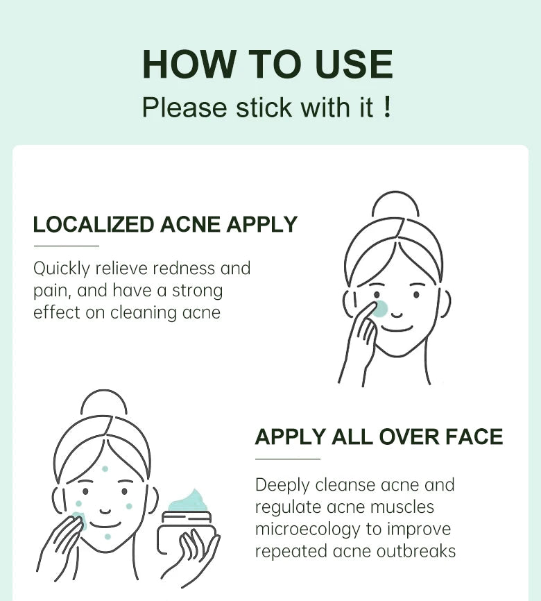 Herbal Acne Face Cream pimple marks removal oil control moisturizing pockmark smooth facial cream skin care products JoyPretty.